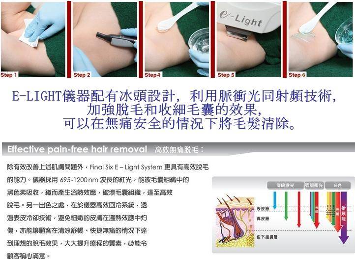 E-LIGHT脫毛 E-LIGHT脫毛