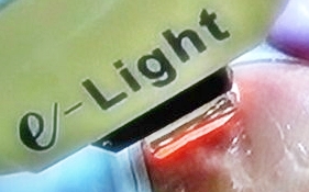 e-light